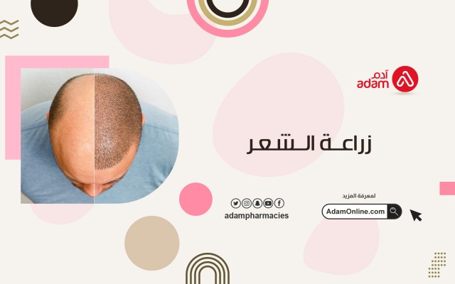 زراعة الشعر